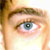 blue eyes